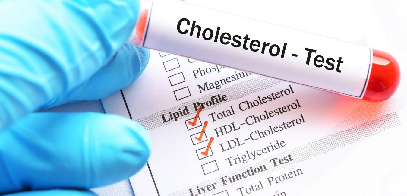 Wysoki cholesterol — kiedy zacząć się martwić?