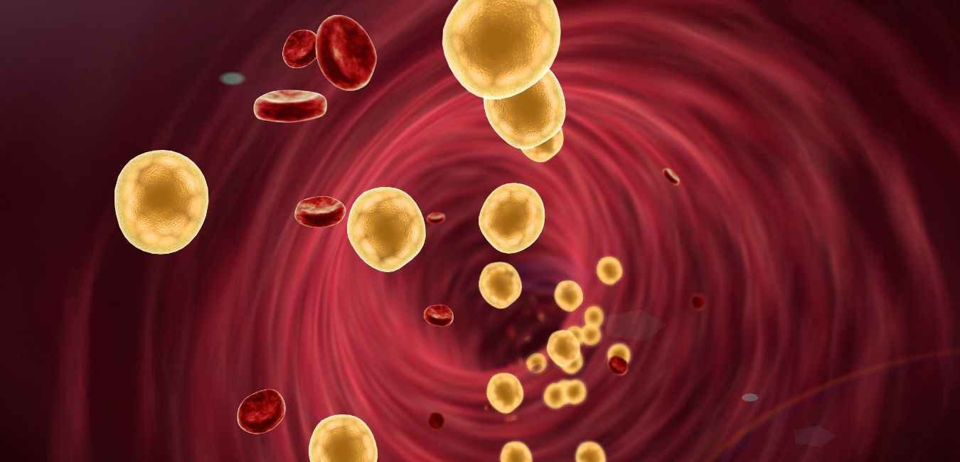 Ezetimib w leczeniu cholesterolemii