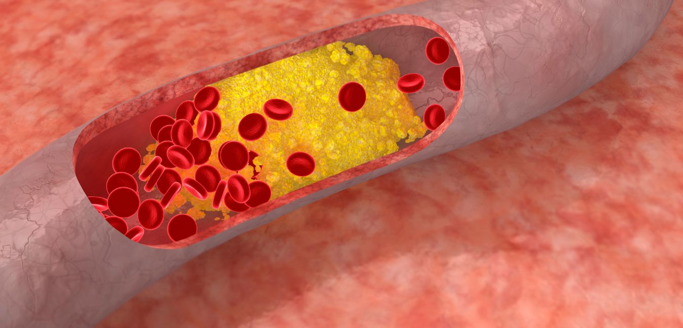 Wyciąg z czerwonego ryżu na cholesterol